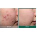 Восстанавливающий крем для проблемной кожи Some By Mi AHA-BHA-PHA 30 Days Miracle Cream (60 гр)